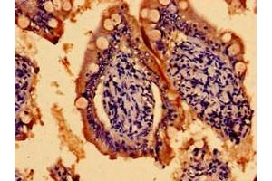 Immunohistochemistry of paraffin-embedded human small intestine tissue using ABIN7159092 at dilution of 1:100 (TMEM67 Antikörper  (AA 241-500))