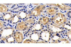 Detection of CASP1 in Human Kidney Tissue using Polyclonal Antibody to Caspase 1 (CASP1) (Caspase 1 Antikörper  (AA 317-404))