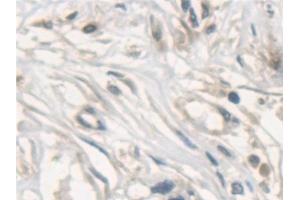 Immunohistochemistry (IHC) image for anti-N-Ethylmaleimide-Sensitive Factor (NSF) (AA 590-744) antibody (ABIN7440899)