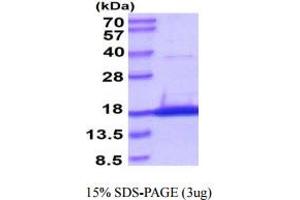 SDS-PAGE (SDS) image for SNAP-Associated Protein (SNAPIN) (AA 1-136) protein (His tag) (ABIN666875) (SNAPIN Protein (AA 1-136) (His tag))