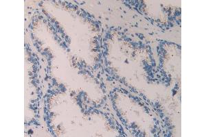 IHC-P analysis of Human Prostate Gland Tissue, with DAB staining. (Contactin 4 Antikörper  (AA 731-980))