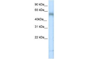 WB Suggested Anti-TBX6 Antibody   Titration: 5 ug/ml   Positive Control: Placenta (T-Box 6 Antikörper  (N-Term))