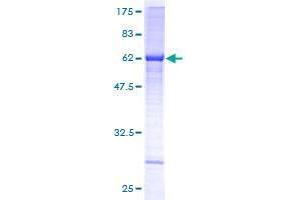 Image no. 1 for Asparagine-Linked Glycosylation 5, Dolichyl-Phosphate beta-Glucosyltransferase Homolog (S. Cerevisiae) (ALG5) (AA 1-324) protein (GST tag) (ABIN1344879) (ALG5 Protein (AA 1-324) (GST tag))