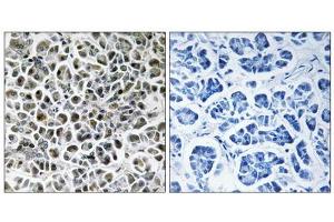 Immunohistochemistry analysis of paraffin-embedded human pancreas tissue using NDUFA3 antibody. (NDUFA3 Antikörper  (Internal Region))
