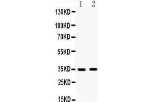 Anti- HSD17B6 antibody, Western blotting All lanes: Anti HSD17B6  at 0. (HSD17B6 Antikörper  (C-Term))