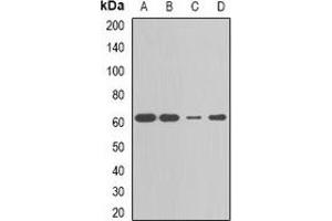 Western blot analysis of CBX4 expression in MCF7 (A), HepG2 (B), Jurkat (C), mouse liver (D) whole cell lysates. (CBX4 Antikörper)