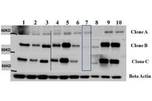 Western Blot of Mouse Anti-AKT3 antibody. (AKT3 Antikörper  (Internal Region) (Biotin))
