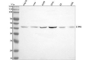 Western blot analysis of S1PR3 using anti-S1PR3 antibody (ABIN7606230).