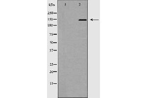Western blot analysis of ACE1 expression in mouse kidney,The lane on the left is treated with the antigen-specific peptide. (Angiotensin I Converting Enzyme 1 Antikörper  (Internal Region))