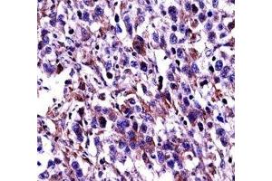 Oct-2 antibody immunohistochemistry analysis in formalin fixed and paraffin embedded human testis carcinoma. (Oct-2 Antikörper  (AA 10-39))