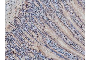Immunohistochemistry (IHC) image for anti-LIM Domain Kinase 1 (LIMK1) (pThr508) antibody (ABIN6255701)