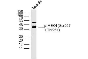 Mouse Muscle lysates probed with p-MEK4(Ser257 + Thr261) Polyclonal Antibody, Unconjugated  at 1:300 dilution and 4˚C overnight incubation. (MAP2K4 Antikörper  (pSer257, pThr261))