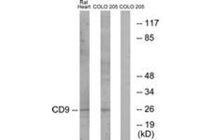 Western blot analysis of extracts from rat heart/COLO cells, using CD9 Antibody.