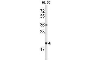Western blot analysis of RNH2C Antibody (Center) in HL-60 cell line lysates (35µg/lane). (RNASEH2C Antikörper  (Middle Region))