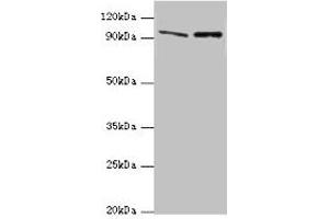 Western blot All lanes: NVL antibody at 10 μg/mL Lane 1: Mouse thymus tissue Lane 2: Hela whole cell lysate Secondary Goat polyclonal to rabbit IgG at 1/10000 dilution Predicted band size: 96, 83, 73, 74, 86 kDa Observed band size: 96 kDa