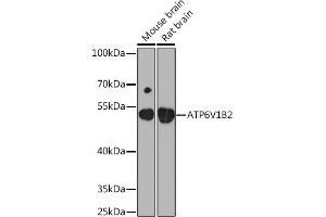 Western blot analysis of extracts of various cell lines, using V1B2 Rabbit pAb  at 1:1000 dilution. (ATP6V1B2 Antikörper  (AA 262-511))