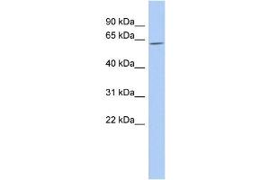 WB Suggested Anti-TULP2 Antibody Titration:  0. (TULP2 Antikörper  (Middle Region))