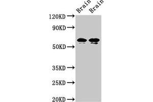 Western Blot Positive WB detected in: Rat brain tissue, Mouse brain tissue All lanes: STXBP1 antibody at 2 μg/mL Secondary Goat polyclonal to rabbit IgG at 1/50000 dilution Predicted band size: 68, 69 kDa Observed band size: 68, 69 kDa (STXBP1 Antikörper  (AA 245-594))