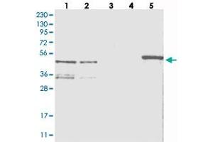 Western blot analysis of Lane 1: RT-4, Lane 2: U-251 MG, Lane 3: Human Plasma, Lane 4: Liver, Lane 5: Tonsil with ZNF641 polyclonal antibody  at 1:250-1:500 dilution. (ZNF641 Antikörper)