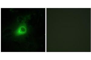 Immunofluorescence analysis of HeLa cells, using GRK6 antibody.