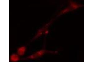 ABIN6275510 staining HT29 cells by IF/ICC.