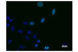 Immunostaining analysis in HeLa cells. (TPX2 Antikörper)