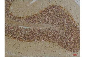 Immunohistochemistry (IHC) analysis of paraffin-embedded Human Brain Tissue using KCNN2(SK2) Rabbit Polyclonal Antibody diluted at 1:200. (KCNN2 Antikörper)