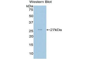 Western Blotting (WB) image for anti-GATA Binding Protein 4 (GATA4) (AA 228-440) antibody (ABIN3208751) (GATA4 Antikörper  (AA 228-440))