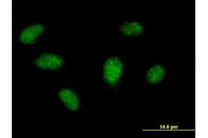 Immunofluorescence of purified MaxPab antibody to BIRC4BP on HeLa cell. (XAF1 Antikörper  (AA 1-301))