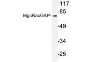 Western blot analysis of MgcRacGAP antibody in extracts from COS7 cells. (RACGAP1 Antikörper)