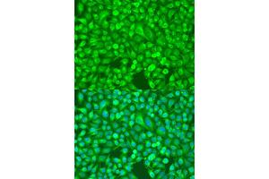 Immunohistochemistry of paraffin-embedded rat heart using NFKB2 Antibody (ABIN1873900) at dilution of 1:100 (40x lens). (NFKB2 Antikörper)