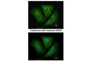 ICC/IF Image Immunofluorescence analysis of methanol-fixed A549, using HLA-DRB3, antibody at 1:500 dilution. (HLA-DRB3 Antikörper)