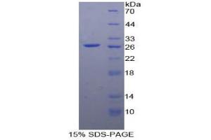 SDS-PAGE analysis of Human EP2 Protein. (PTGER2 Protein)