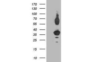 Western Blotting (WB) image for anti-Pleckstrin Homology Domain Containing Family A3 (PLEKHA3) antibody (ABIN1500275) (PLEKHA3 Antikörper)