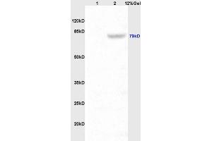 Lane 1: rat kidney lysates Lane 2: mouse intestine lysates probed with Anti P-cadherin Polyclonal Antibody, Unconjugated (ABIN738531) at 1:200 in 4 °C. (P-Cadherin Antikörper  (AA 625-725))
