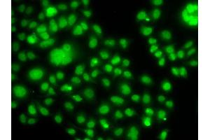 Immunofluorescence analysis of MCF7 cell using SOX14 antibody. (SOX14 Antikörper)