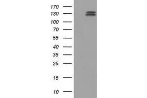 Western Blotting (WB) image for anti-L1 Cell Adhesion Molecule (L1CAM) antibody (ABIN1499085)