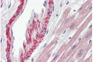 Immunohistochemistry (IHC) image for anti-Adaptor-Related Protein Complex 1, sigma 2 Subunit (AP1S2) (AA 1-122) antibody (ABIN1804270)