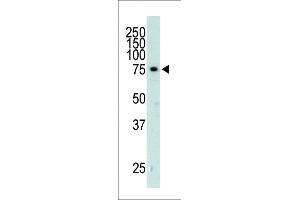 The anti-GRK3 Pab (ABIN390986 and ABIN2841169) is used in Western blot to detect GRK3 in mouse heart tissue lysate. (AD_K2 (AA 633-660), (C-Term) Antikörper)