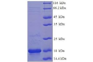 SDS-PAGE (SDS) image for Frataxin (FXN) (AA 42-210) protein (His tag) (ABIN1636490)