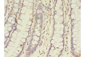 Immunohistochemistry of paraffin-embedded human colon tissue using ABIN7145877 at dilution of 1:100 (BTN2A1 Antikörper  (AA 29-248))