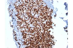 Formalin-fixed, paraffin-embedded human Tonsil stained with Ki67-Monospecific Mouse Monoclonal Antibody (MKI67/2462). (Ki-67 Antikörper  (AA 2293-2478))