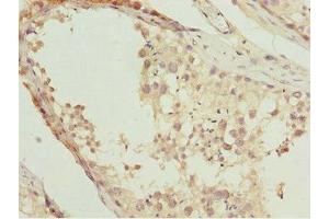 Immunohistochemistry (IHC) image for anti-Nuclear Receptor Subfamily 2, Group E, Member 1 (NR2E1) (AA 106-385) antibody (ABIN7161905)