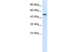 WB Suggested Anti-SBZF3 Antibody Titration:  1. (ZNF695 Antikörper  (N-Term))