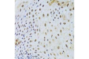 Immunohistochemistry of paraffin-embedded human esophagus using KRT8 Antibody. (KRT8 Antikörper  (AA 1-483))