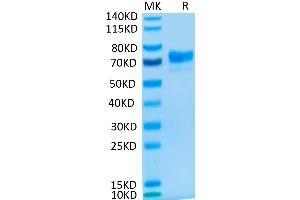 Cynomolgus MSLN on Tris-Bis PAGE under reduced condition. (Mesothelin Protein (MSLN) (Fc Tag))
