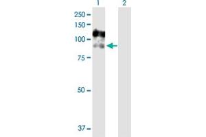 Western Blot analysis of CSF3R expression in transfected 293T cell line by CSF3R MaxPab polyclonal antibody. (CSF3R Antikörper  (AA 1-836))