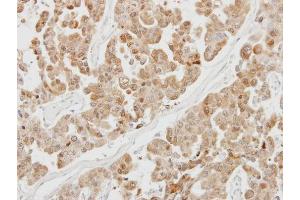 Immunohistochemistry (IHC) image for anti-Proteasome (Prosome, Macropain) Subunit, beta Type, 5 (PSMB5) (C-Term) antibody (ABIN2855902)
