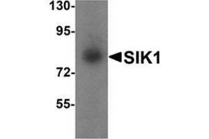 Western blot analysis of SIK1 in human small intestine tissue lysate with SIK1 antibody at 1 μg/ml. (SIK1 Antikörper  (Center))