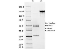 SDS-PAGE Analysis of Purified, BSA-Free CD4 Antibody (clone C4/206).
